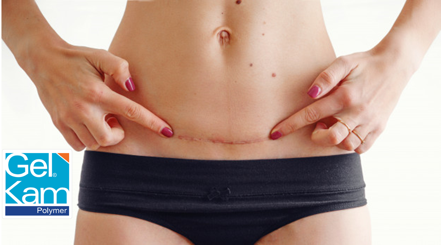 Gel Abdominal